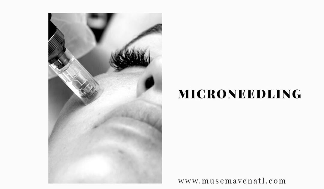 How Often Do You Need Microneedling?