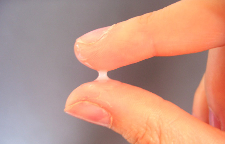 Khí hư làm rách quần lót là bệnh gì? Cách điều trị dứt điểm