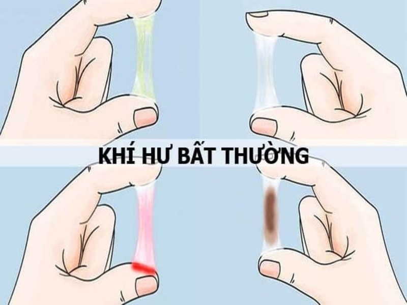 Ưu nhược điểm của các cách điều trị viêm nhiễm phụ khoa hiện nay