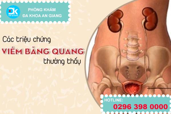 Các triệu chứng viêm bàng quang thường thấy
