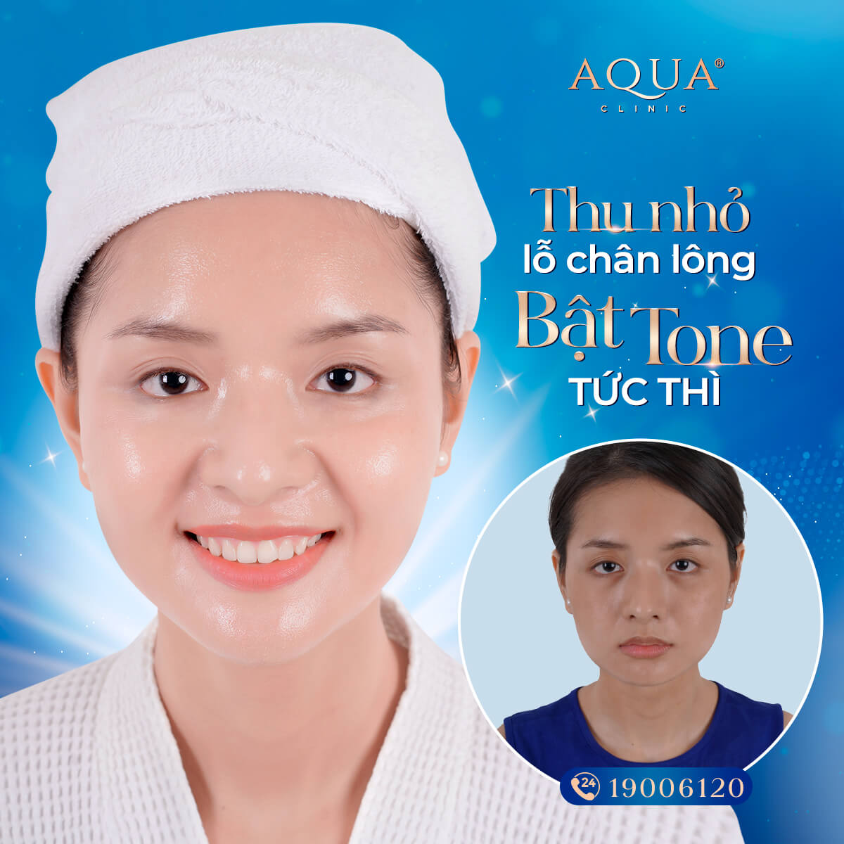PRP trẻ hoá phục hồi: 4 + Ưu điểm nổi bật của phương pháp