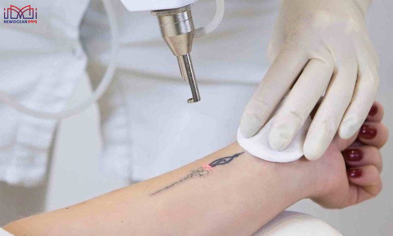 Có hình xăm có đi định cư Mỹ được không? Chuyên gia giải đáp