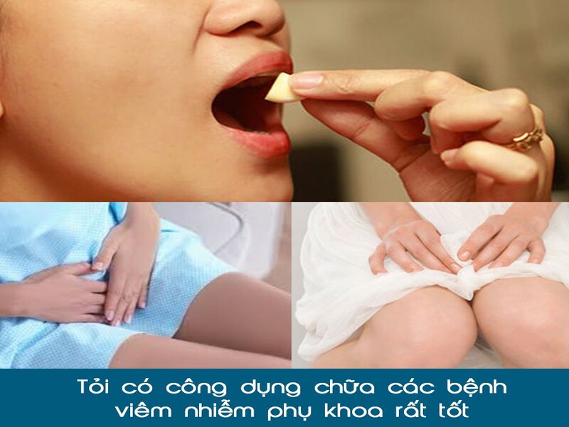 Mách Bạn Mẹo Chữa Viêm Phụ Khoa An Toàn Và Hiệu Quả