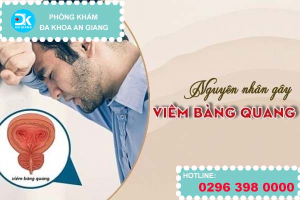 Nguyên nhân gây viêm bàng quang
