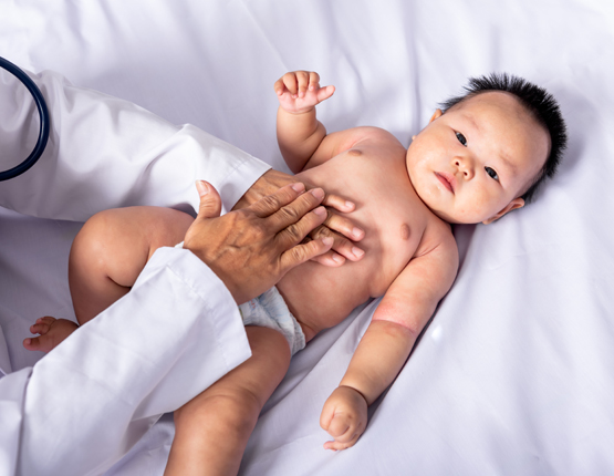 Anorectal Malformation Treatment | Alsa Pakistan