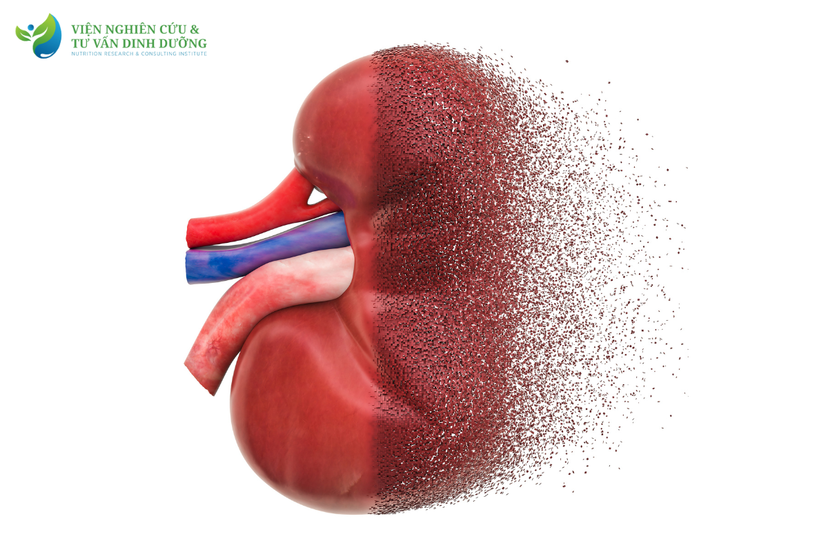 Chế độ ăn cho bệnh nhân suy thận mạn cần lưu ý - NRECI