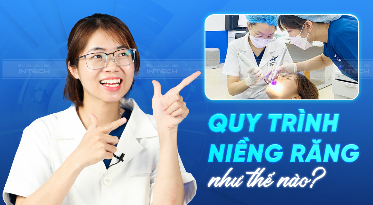 Quy trình niềng răng như thế nào? Các bước niềng răng hoàn chỉnh