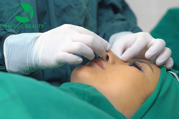Nâng mũi sụn tự thân có vĩnh viễn không - Thẩm mỹ Thu Cúc