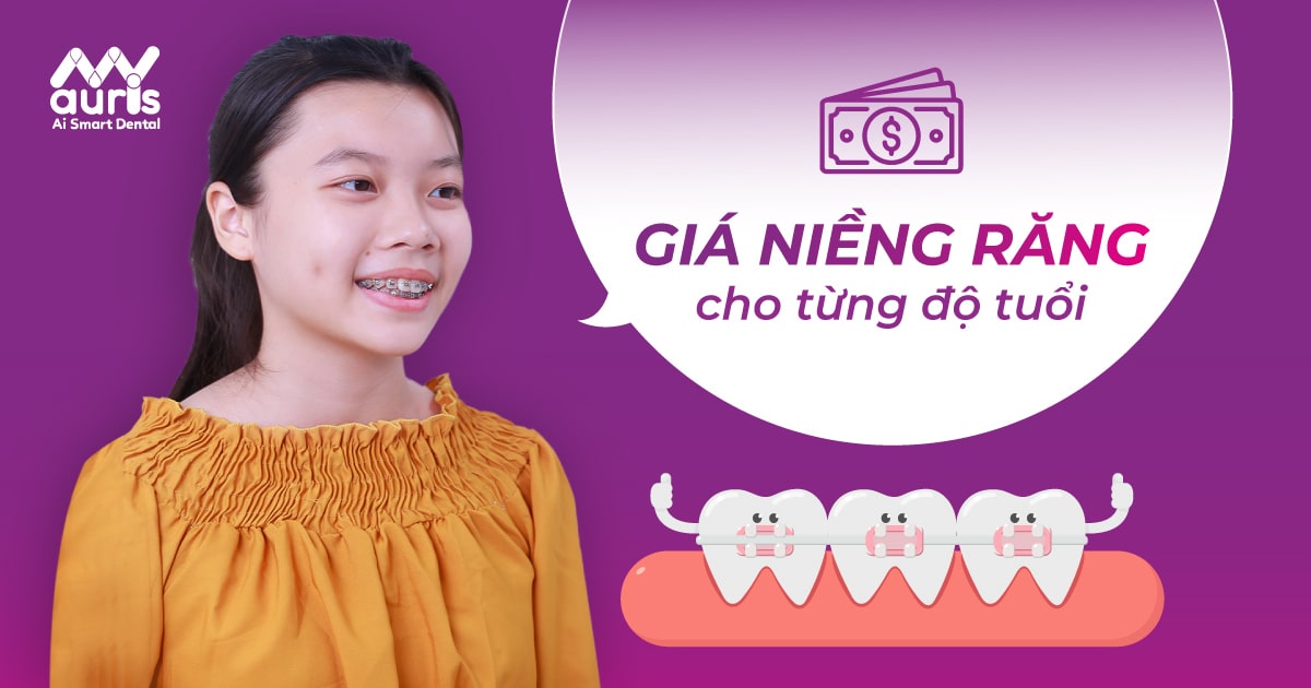 Giá niềng răng cho trẻ 10 tuổi có đắt không? - Nha Khoa My Auris
