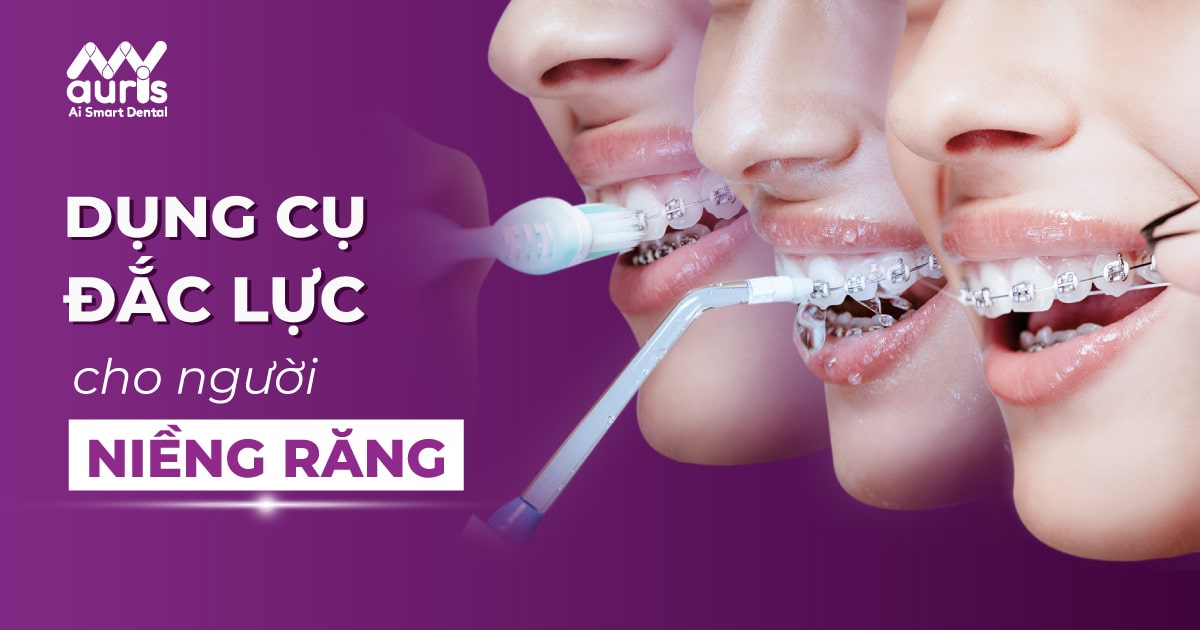 Những dụng cụ cần thiết khi niềng răng mà người niềng cần phải có - Nha Khoa My Auris