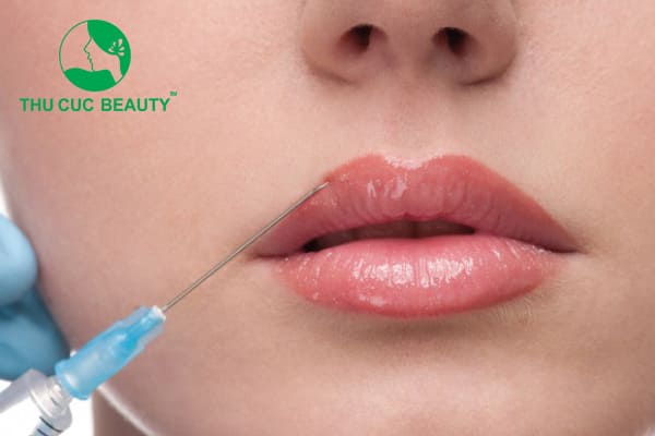 Tiêm filler môi trái tim - Thu Cúc Sài Gòn