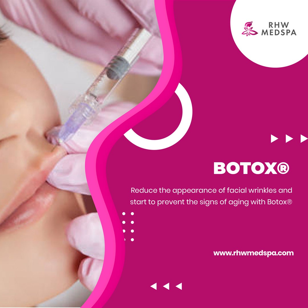 What Is The Right Time To Get Botox Done? | by Rhwmedspa | Nov, 2022 | Medium