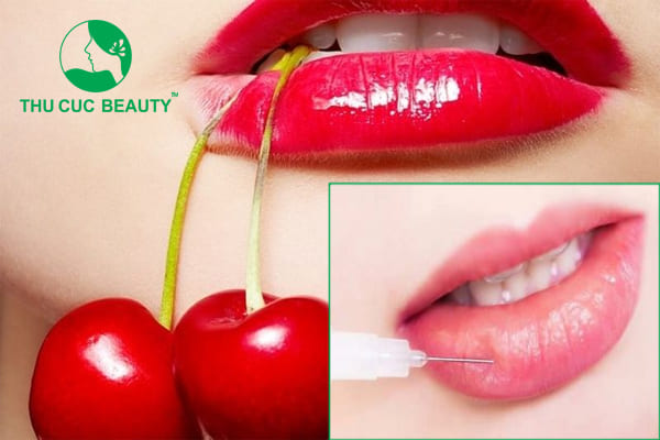 Tiêm môi cherry - Môi căng mọng quyến rũ - Thu Cúc Sài Gòn
