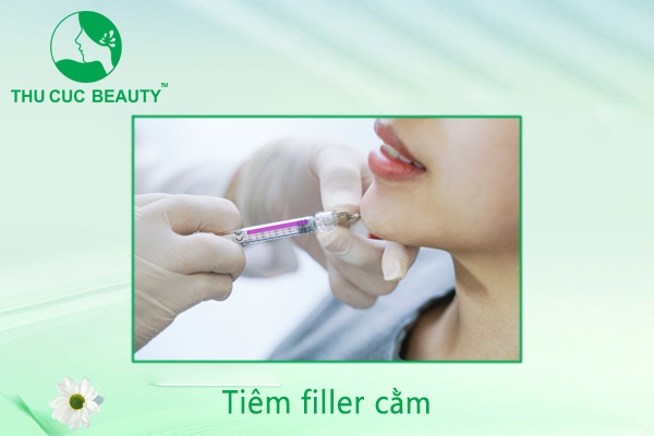 Tiêm filler cằm - Dáng Vline thời thượng