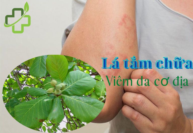 Top 10 loại lá tắm chữa viêm da cơ địa tại nhà an toàn, hiệu quả