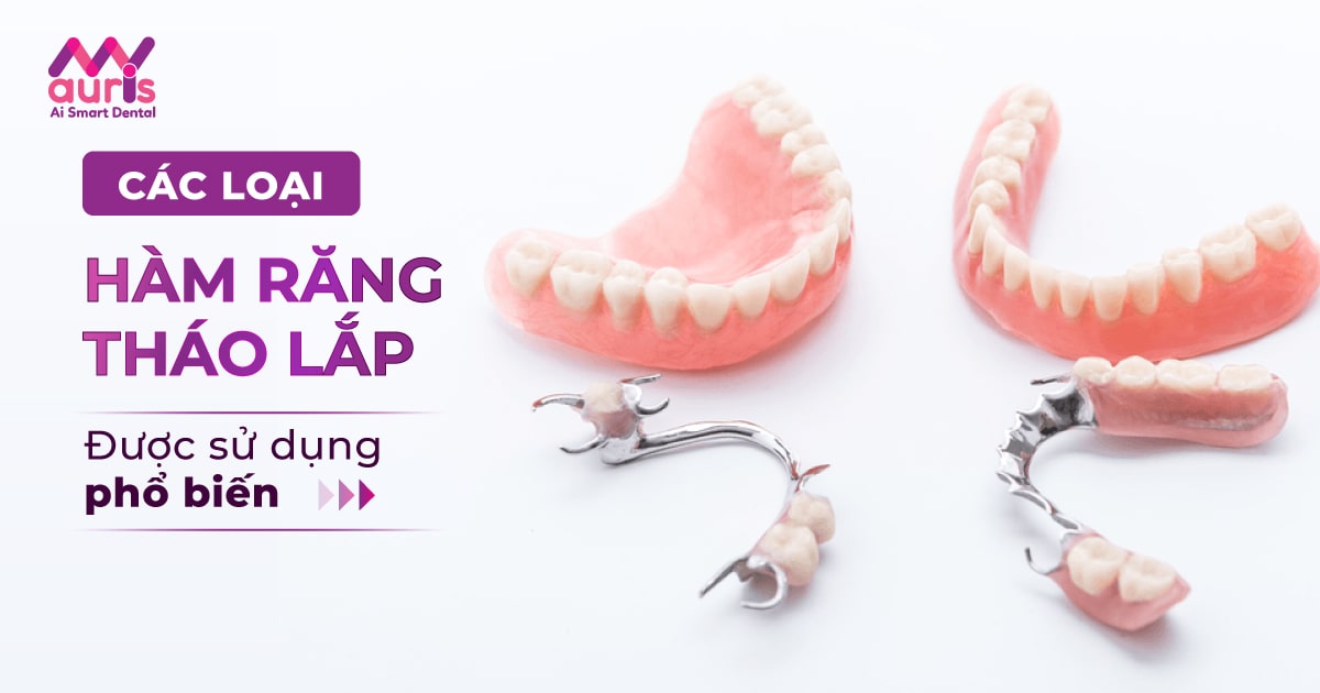 Bảng giá làm răng giả tháo lắp - Nha Khoa My Auris