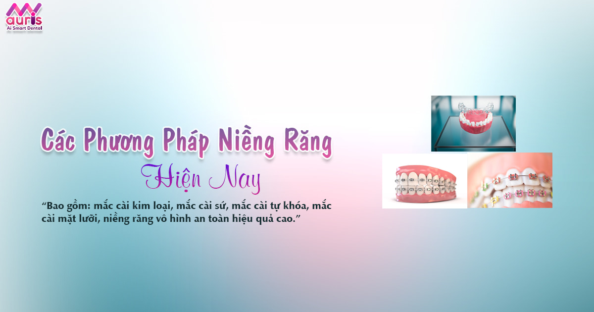 Tổng hợp các phương pháp niềng răng hiện nay - Nha Khoa My Auris