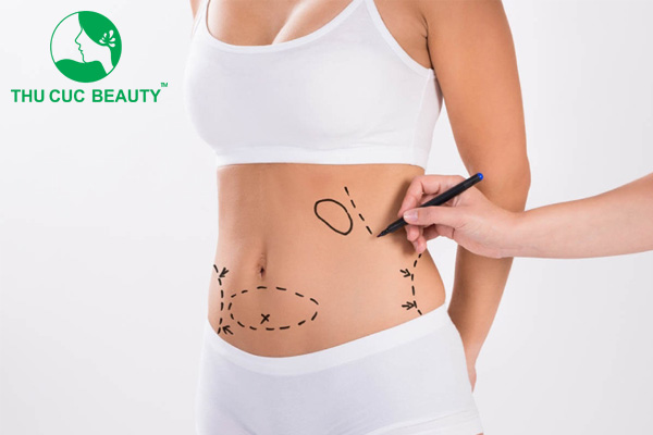 Tạo hình thành bụng - Thẩm mỹ Thu Cúc