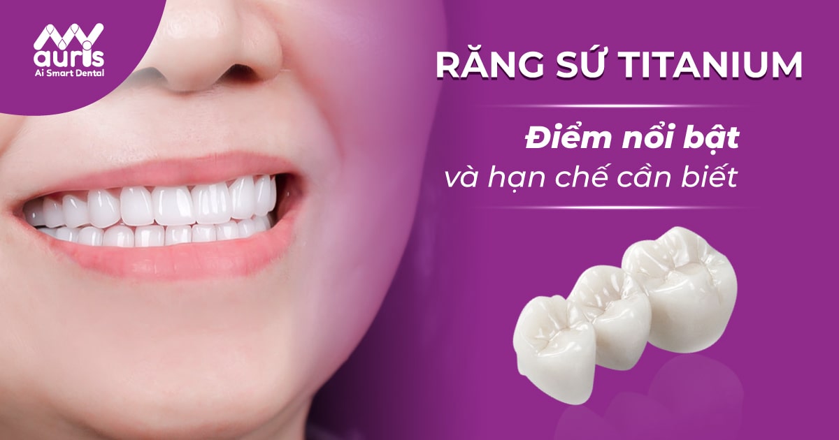 Các loại răng sứ Titanium và những điều cần biết - Nha Khoa My Auris