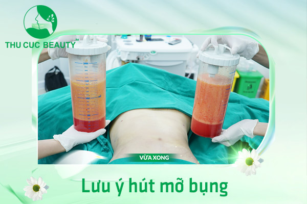 Lưu ý hút mỡ bụng - Thu Cúc Sài Gòn