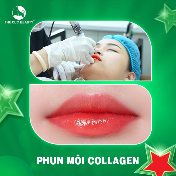 Phun môi collagen - Thu Cúc Sài Gòn