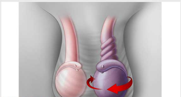 13 lý do dẫn đến vô sinh ở nam giới
