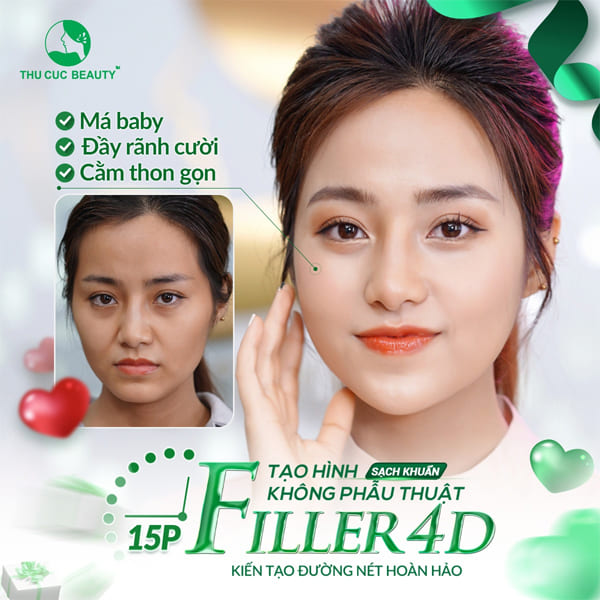 Có nên tiêm filler má không? - Thu Cúc Sài Gòn