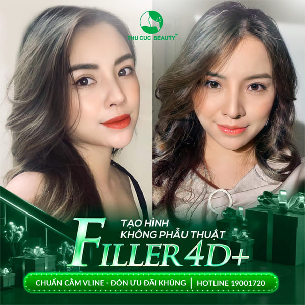Có nên tiêm filler cằm không? - Thu Cúc Sài Gòn