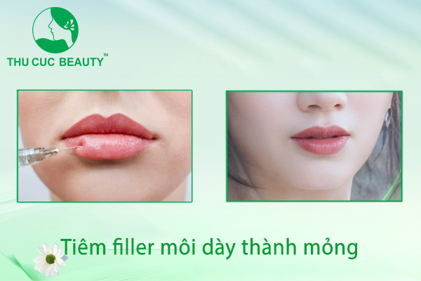 Tiêm filler môi dày thành mỏng - Thu Cúc Sài Gòn