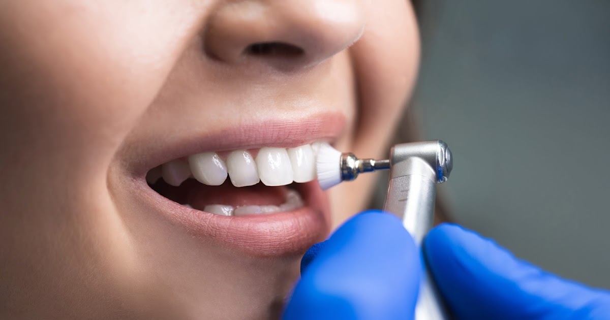 Teeth Cleaning vs. Whitening: Know the Difference