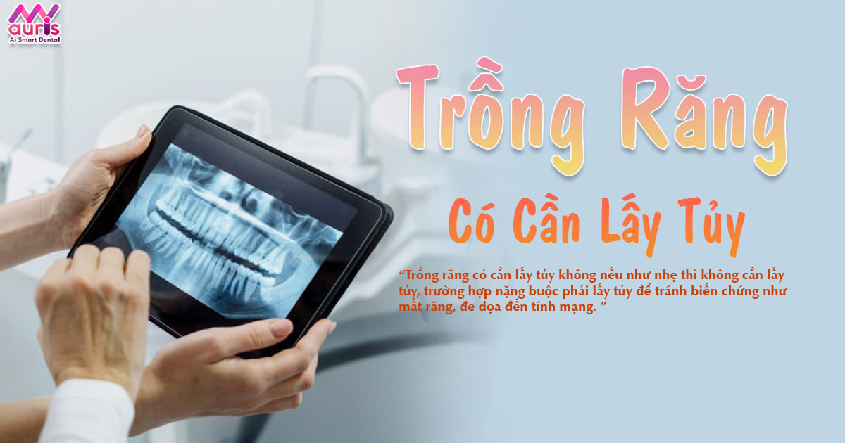 [Hỏi đáp] trồng răng có cần lấy tủy không?