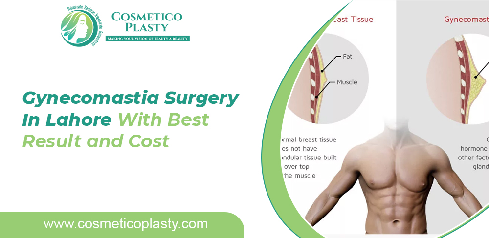 Gynecomastia Surgery In Lahore | Treatment of Gynecomastia