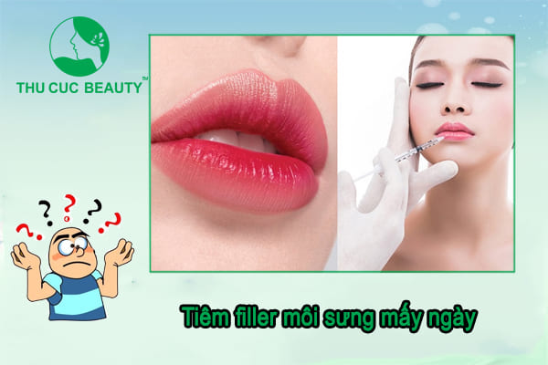 Tiêm filler môi sưng mấy ngày? - Thu Cúc Sài Gòn