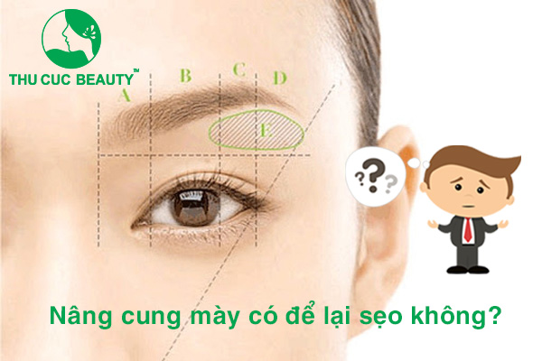 Nâng cung mày có sẹo không? - Thu Cúc Sài Gòn
