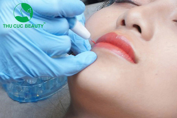 Phun môi - Chỉ 30p môi đẹp rạng ngời - Thu Cúc Sài Gòn