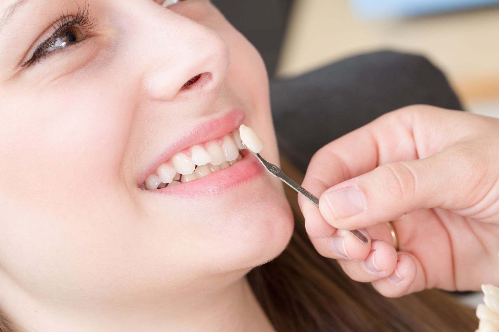 Teeth Whitening - What Are the Side Effects of Teeth Whitening?