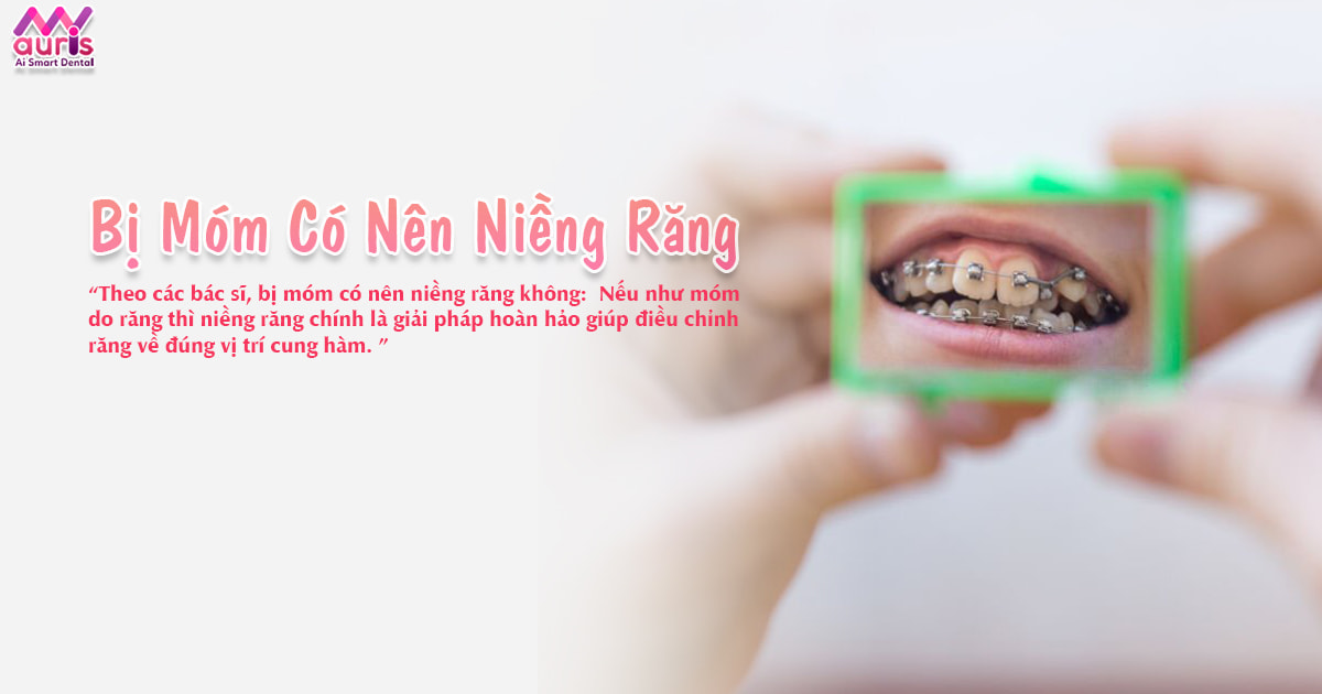 Bị móm có nên niềng răng - Có hết móm không?