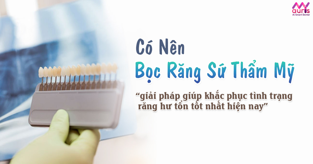 Có nên bọc răng sứ thẩm mỹ không và cho trường hợp nào? - Nha Khoa My Auris