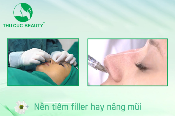 Nên tiêm filler hay nâng mũi - Thu Cúc Sài Gòn