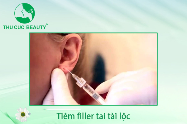 Tiêm filler tai tài lộc - Thu Cúc Sài Gòn