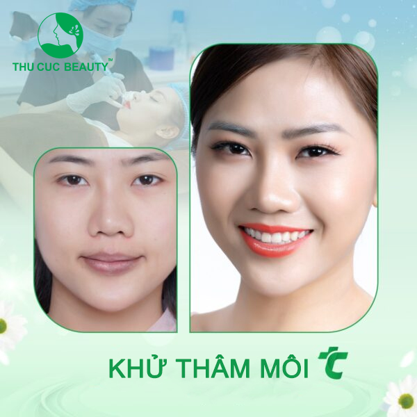 Khử thâm môi - Thu Cúc Sài Gòn