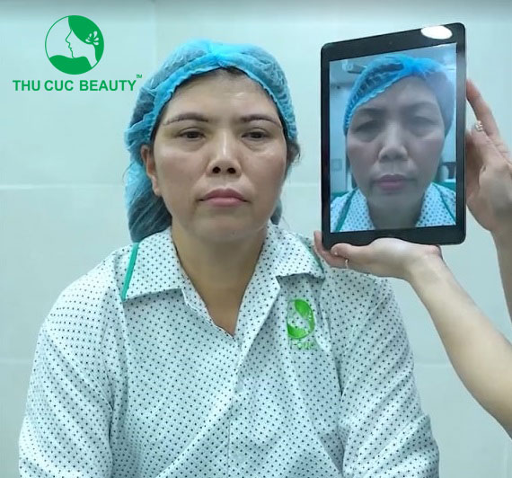 Giá tiền treo chân mày - Thu Cúc Sài Gòn