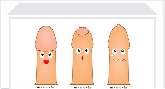 Bao quy đầu như thế nào là phải cắt