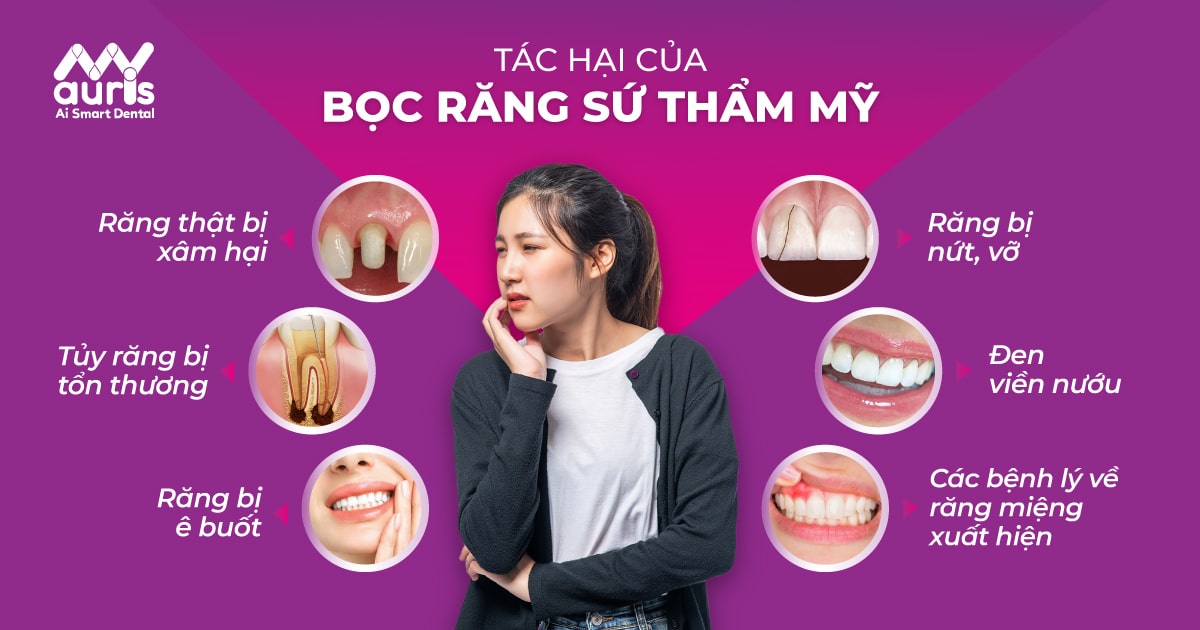Cập nhật các tác hại của bọc răng sứ thẩm mỹ - Nha Khoa My Auris