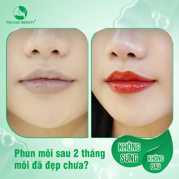 Phun môi sau 2 tháng môi đã đẹp chưa? - Thu Cúc Sài Gòn