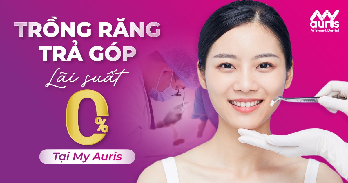 Trồng răng implant trả góp lãi xuất 0% tại My Auris - Nha Khoa My Auris