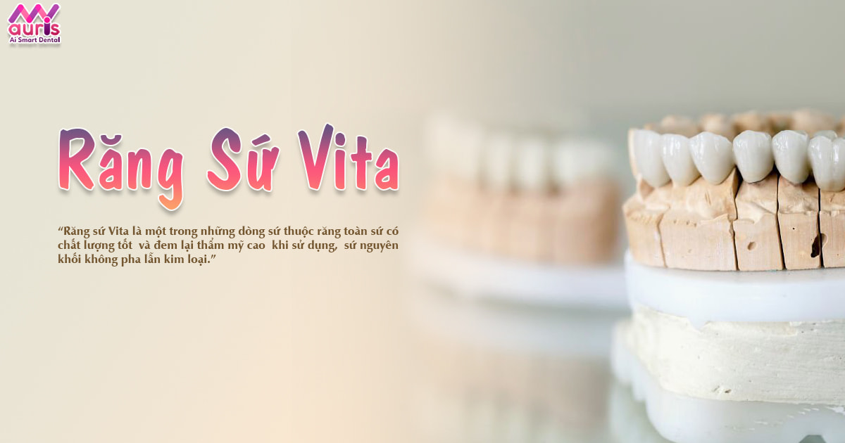 Răng sứ Vita những đặc điểm nổi bật - Nha Khoa My Auris
