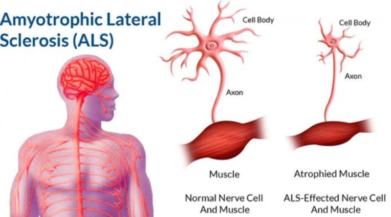 What Does a neurologist do? – Amar Hospital Consultant in Mohali