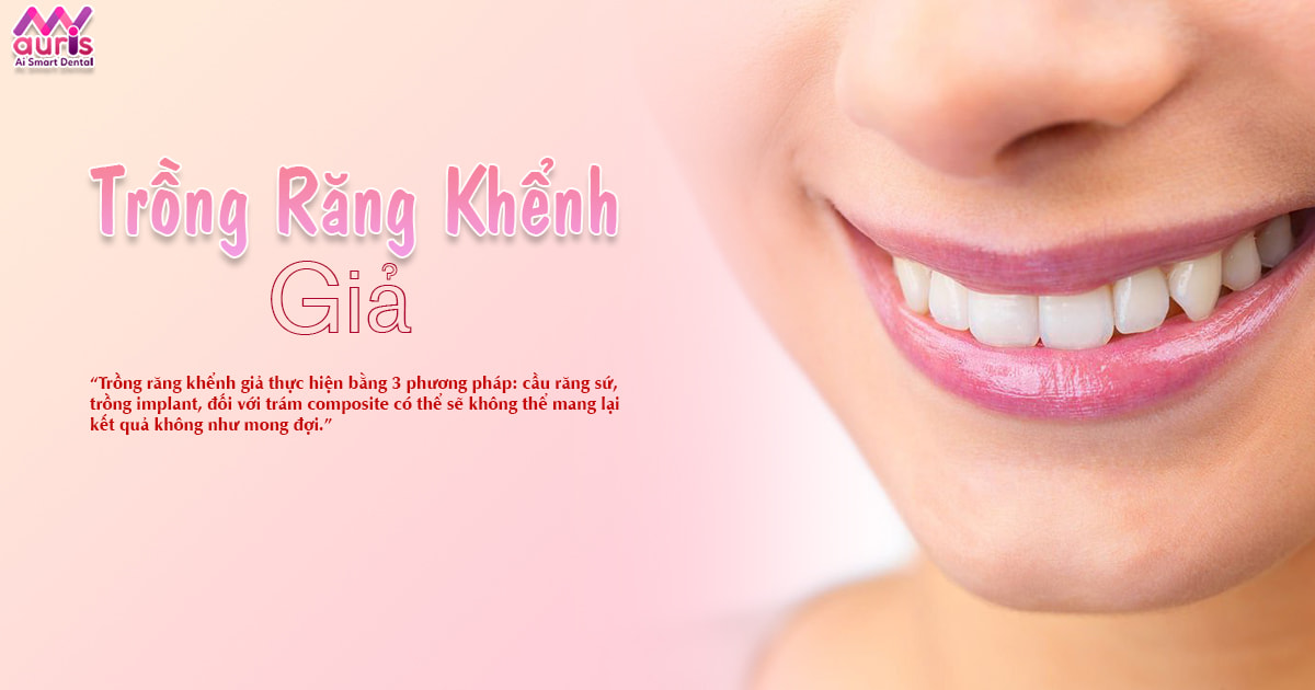 Trồng răng khểnh giả: Phương pháp và quy trình thực hiện - Nha Khoa My Auris