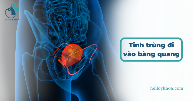 Tinh trùng đi vào bàng quang nguy hiểm không? Nguyên nhân từ đâu?